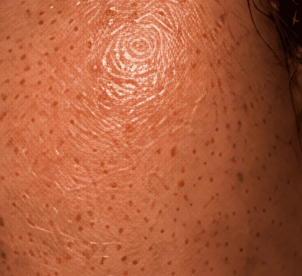 Close view of natural skin texture