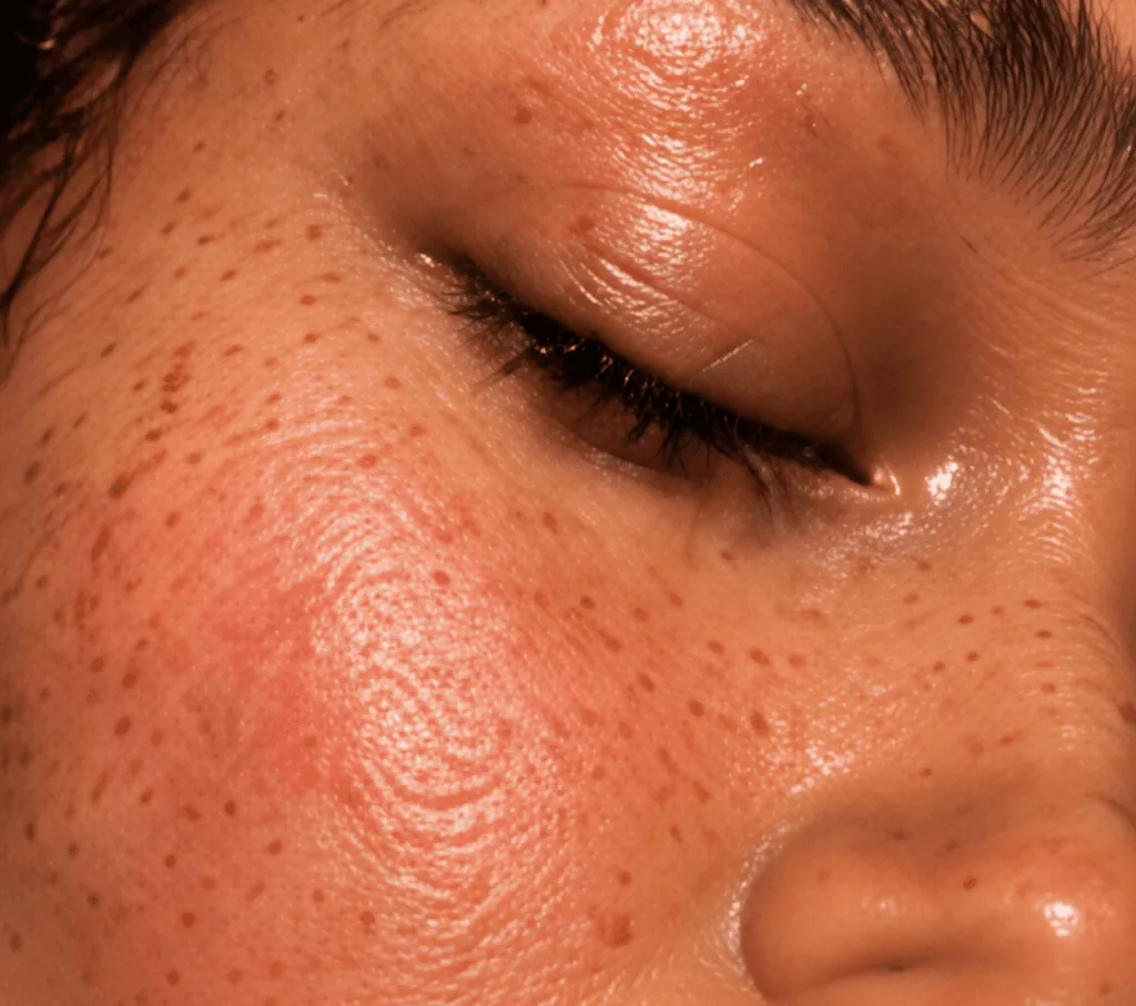 Close view of cheek and closed eye